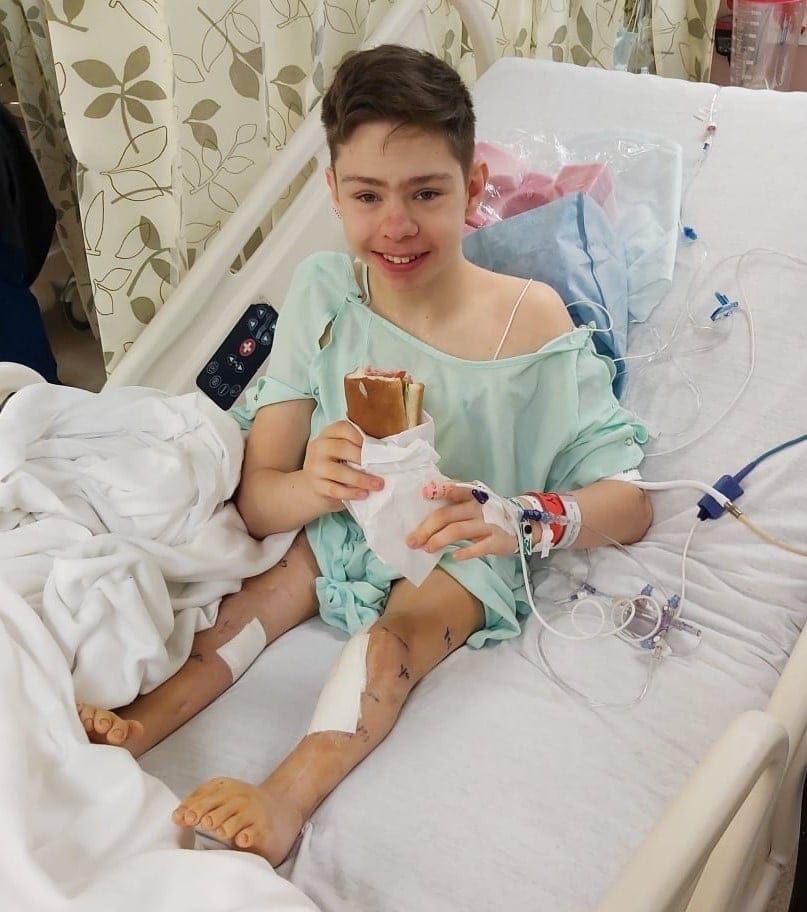 Marko v ZDA prestal zadnjo operacijo nog