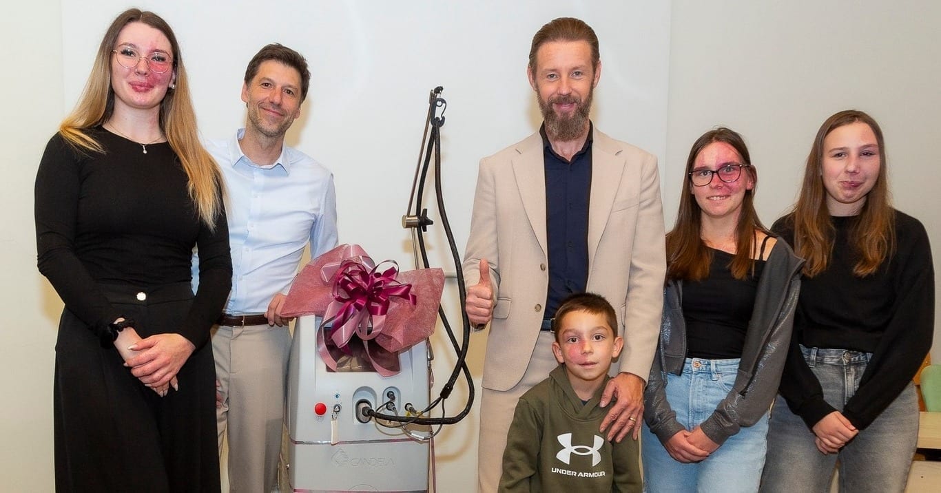 Otroci in mladostniki z ognjenim znamenjem ob predaji PDL laserja Dermatovenerološki kliniki