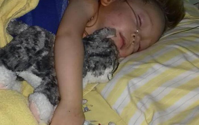 Jernej - Kromosomska delecija - 16p11.2