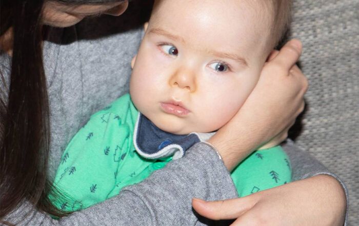 Žiga - Menkesova bolezen